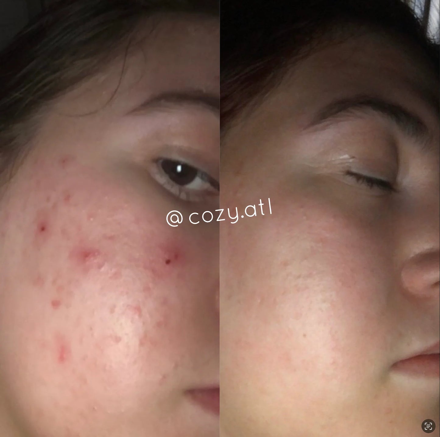 Rain Dance™ Daily Moisturizer + African Detox Soap Bundle